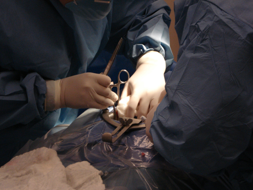 surgical operation