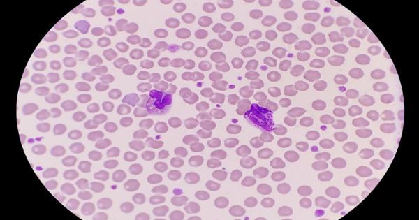 Photo for 
Peripheral Blood Mononuclear Cells (PBMCs)
