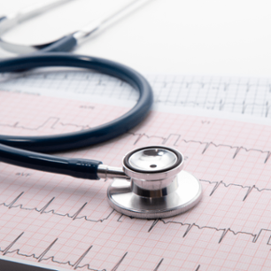 Blue Stethoscope on electrocardiogram (ECG) chart paper. ECG heart chart scan isolate on white.
