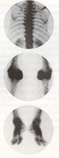 nucleid scan