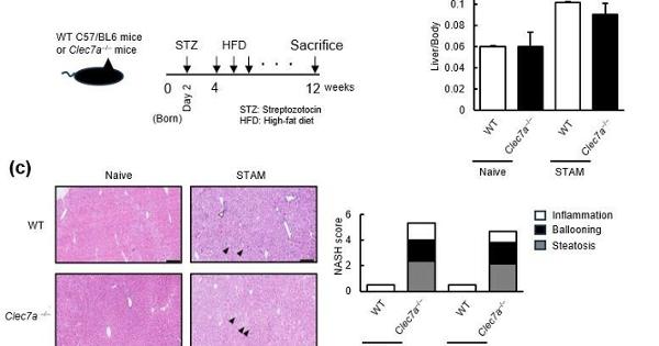 nash-induced liver pathology